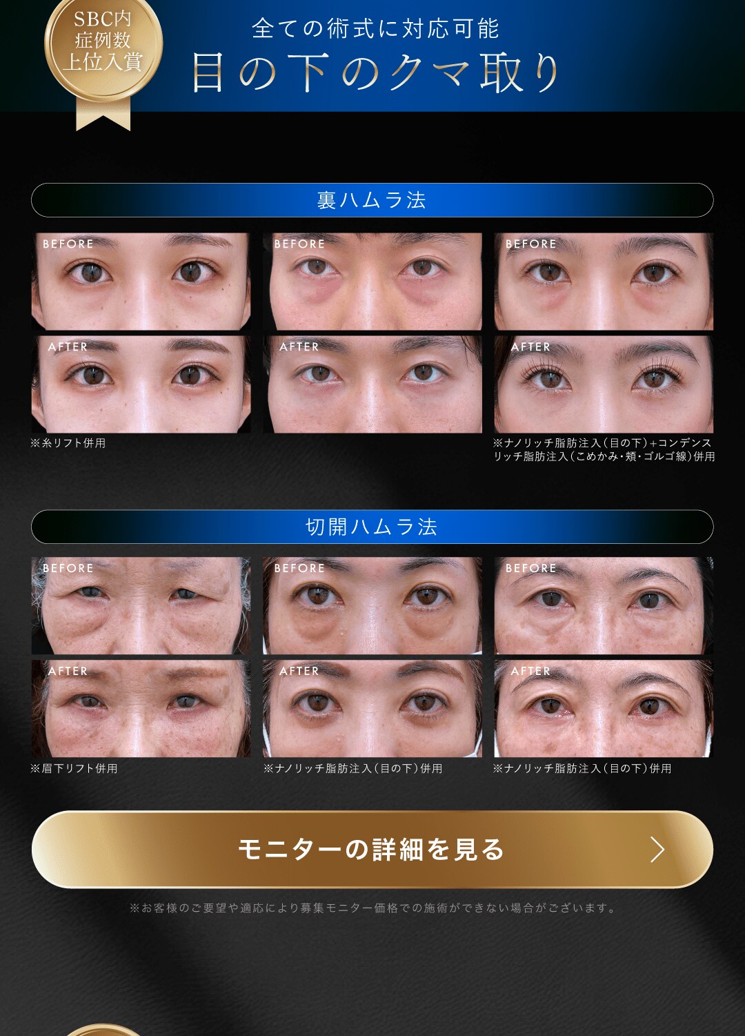 目の下のくまとり