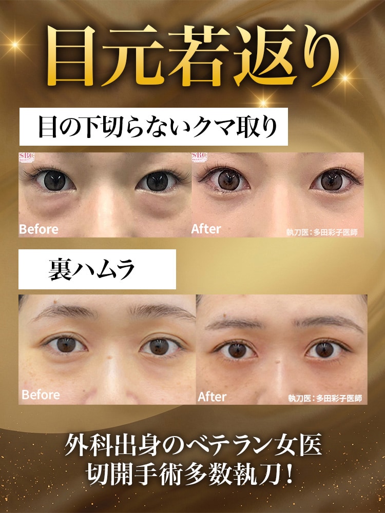 若返り症例