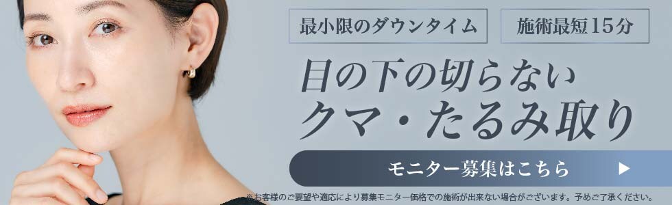クマ取りモニター募集