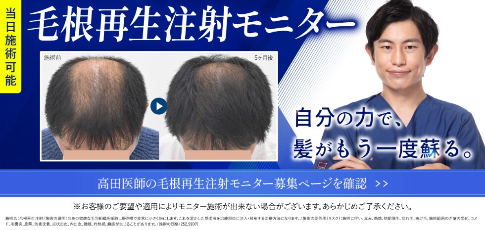 モニター募集