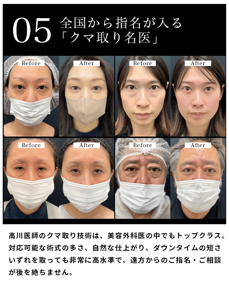 選ばれる理由