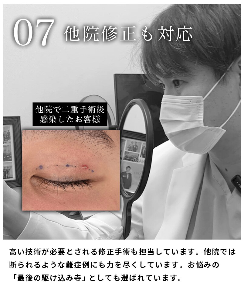 選ばれる理由