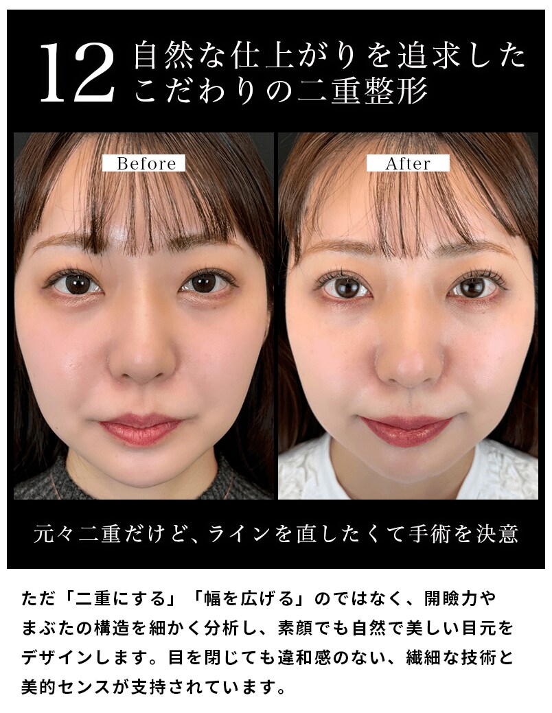 選ばれる理由