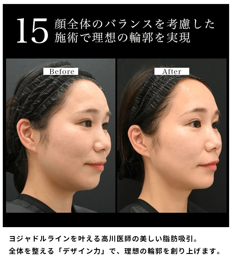 選ばれる理由