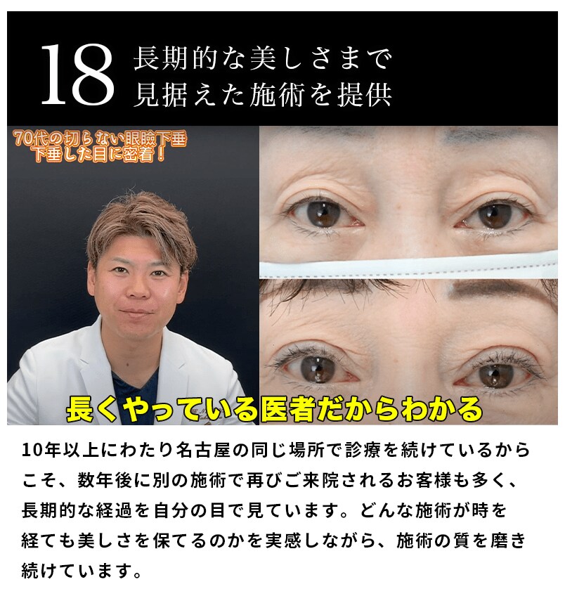 選ばれる理由
