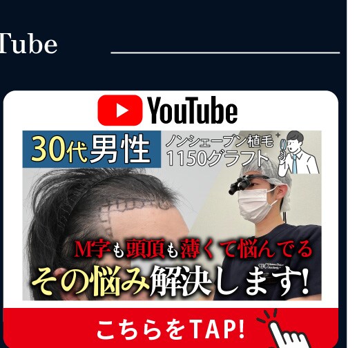 Instagram 顔の脂肪吸引