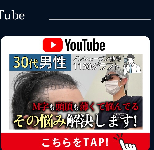 Instagram 顔の脂肪吸引