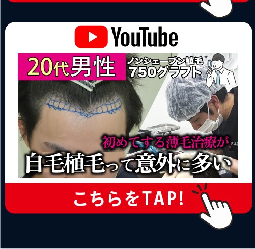 Instagram 目の下のクマ治療