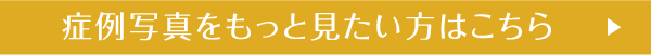 症例写真をもっと見たい方はこちら