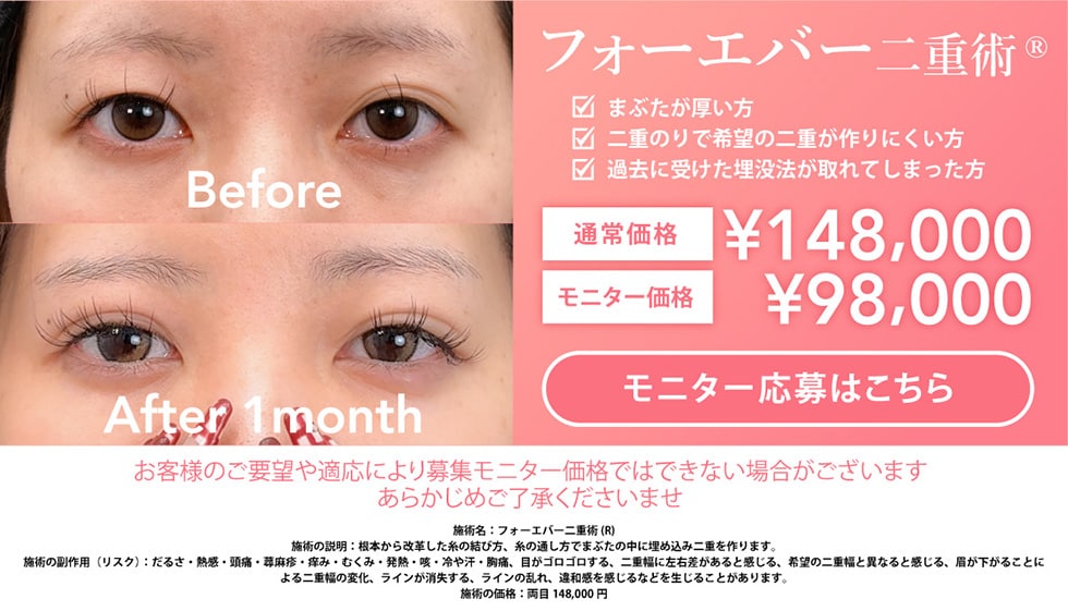 forever二重術モニター募集