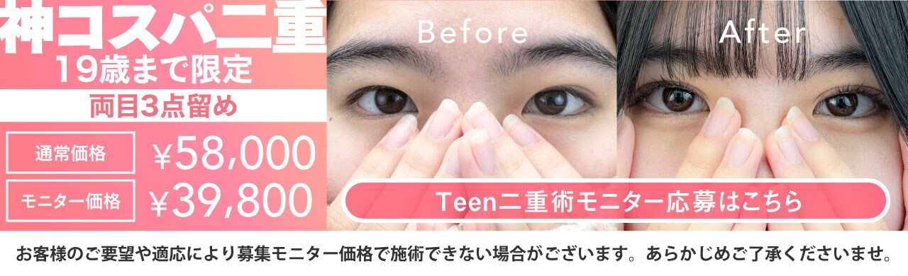 Teen二重術モニター募集