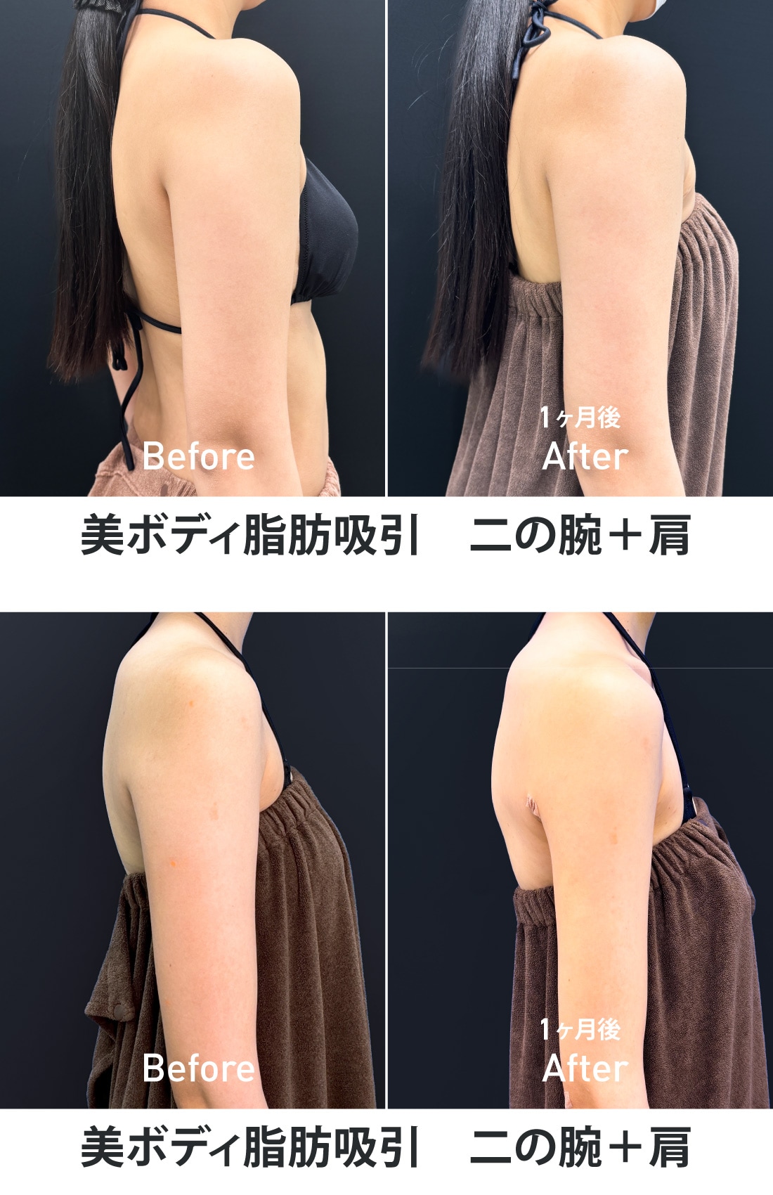 症例