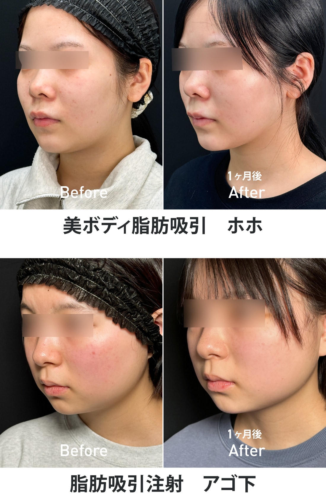 症例