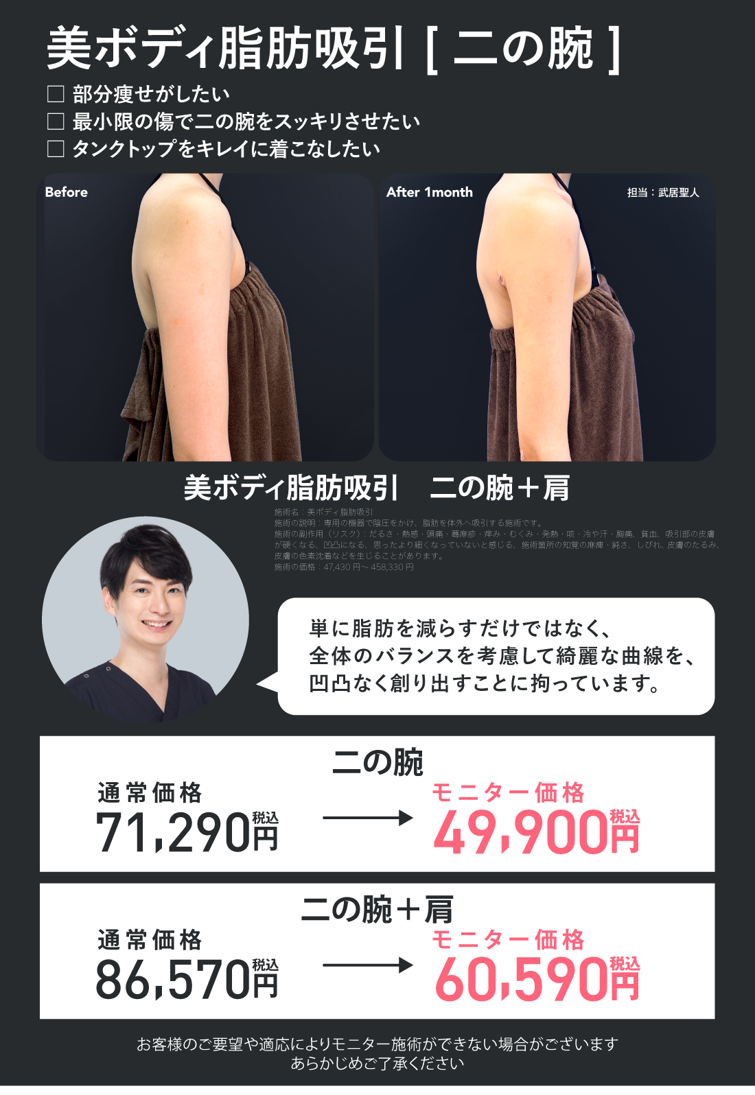 美ボディ脂肪吸引 二の腕