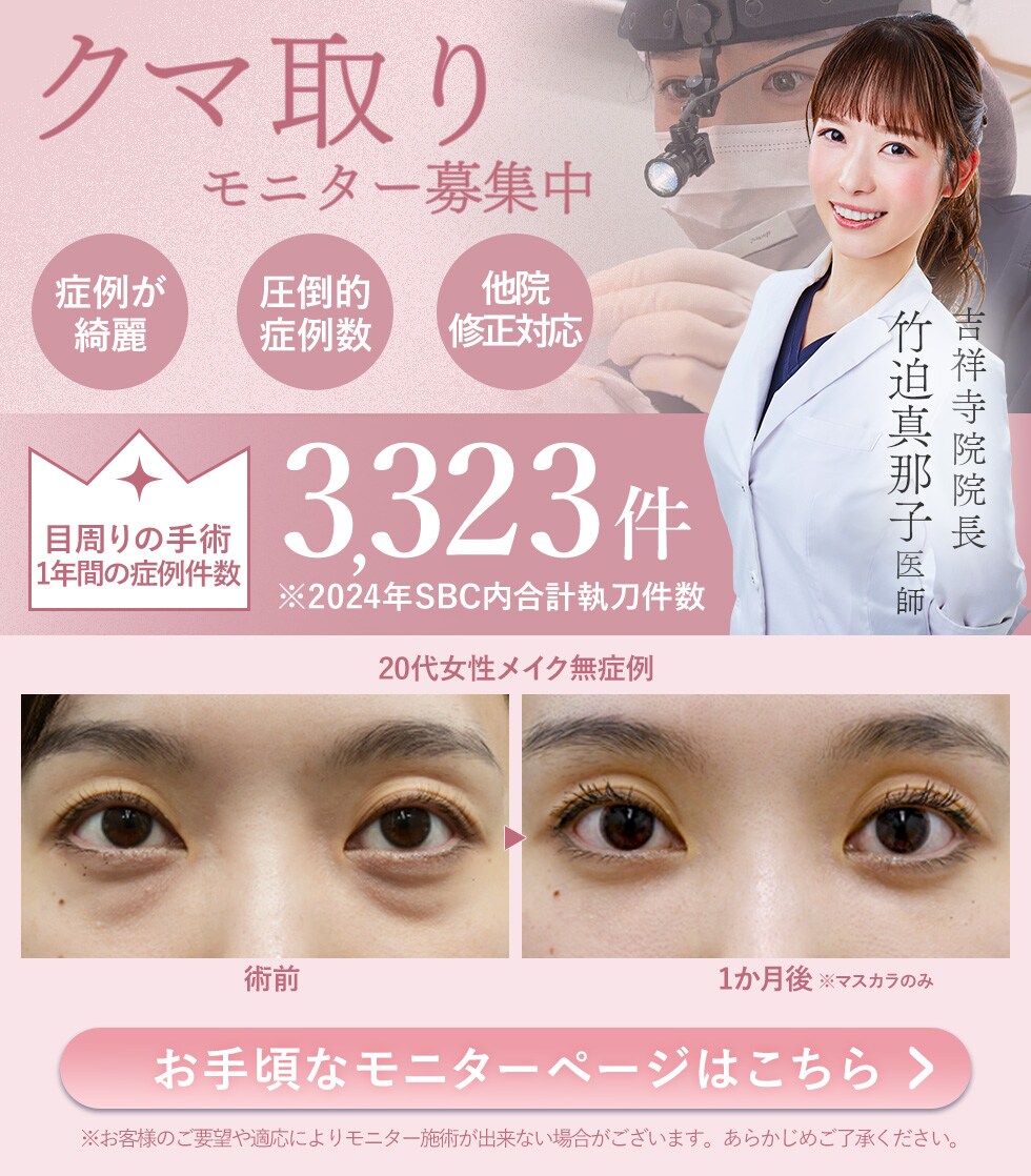 クマ取りモニター