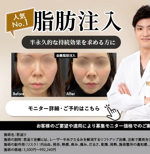 脂肪注入