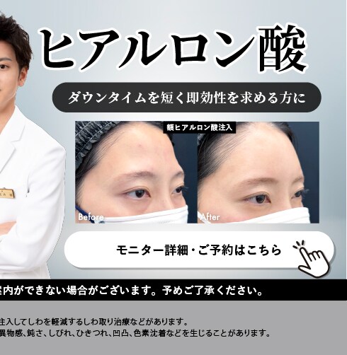 ヒアルロン酸