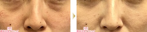 症例写真1