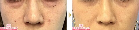 症例写真3