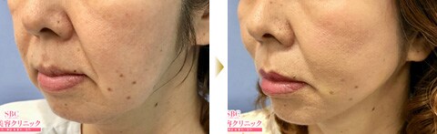 症例写真6