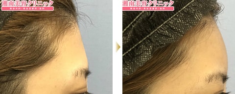 症例写真9