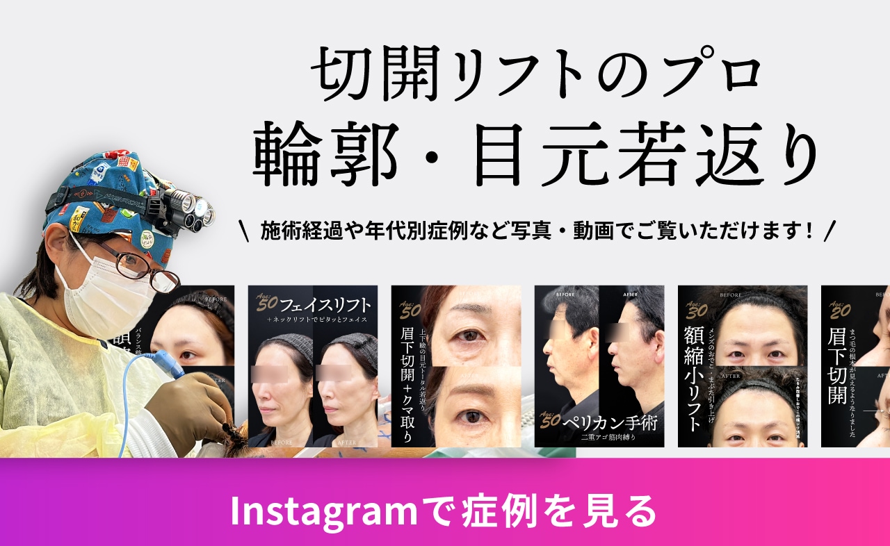 切開リフトのプロ 輪郭・目元若返り