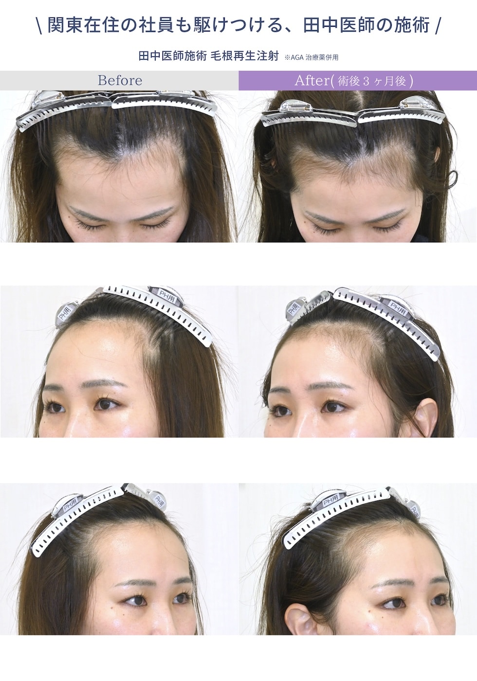 田中いしの施術