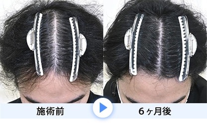症例写真1