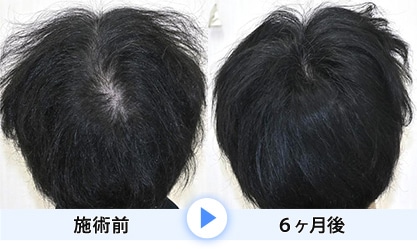 症例写真1