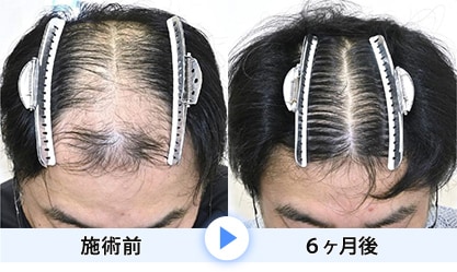 症例写真1