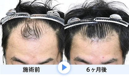 症例写真1