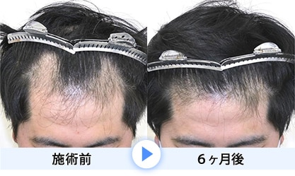 症例写真1