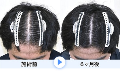 症例写真1