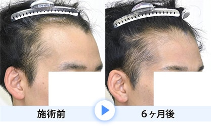 症例写真1