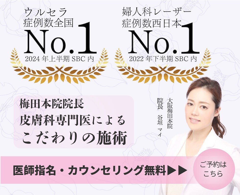 モニター募集