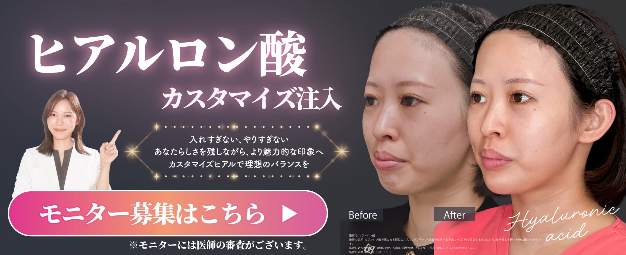 ヒアルロン酸 モニター募集