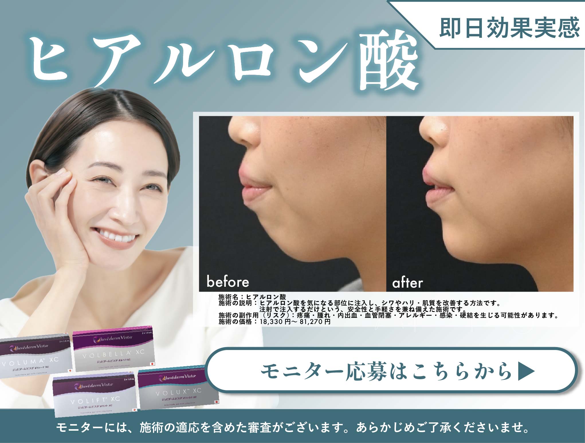 ヒアルロン酸