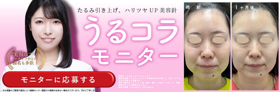 ウルコラモニター