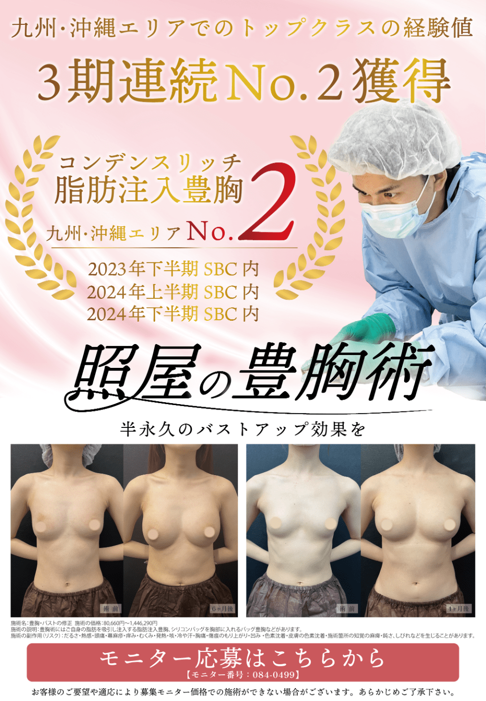 脂肪注入豊胸モニター募集