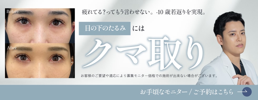 クマとりモニター