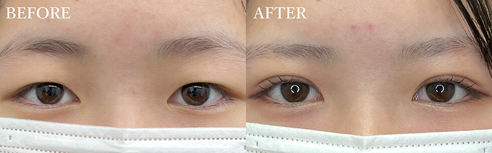 症例写真5