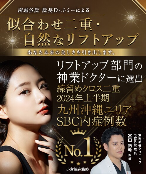 似合わせ二重・自然なリフトアップ