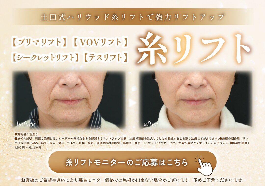 糸リフトモニター