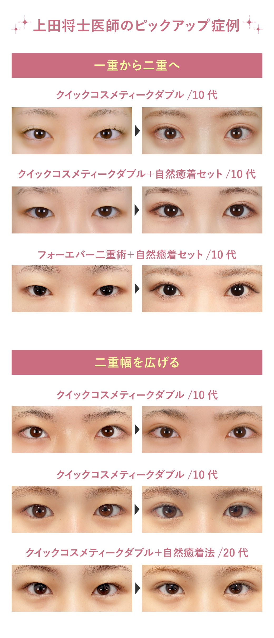 症例紹介