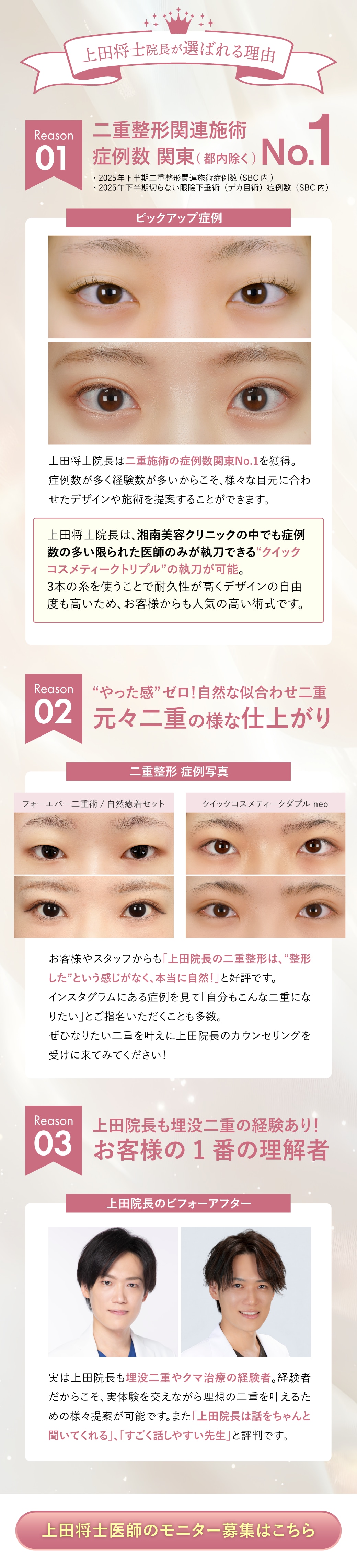 選ばれる理由