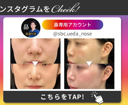 鼻 Instagram