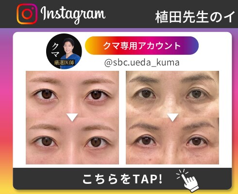 クマ Instagram
