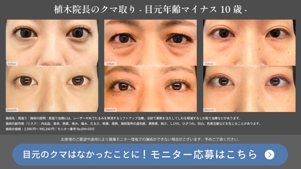 裏下モニター