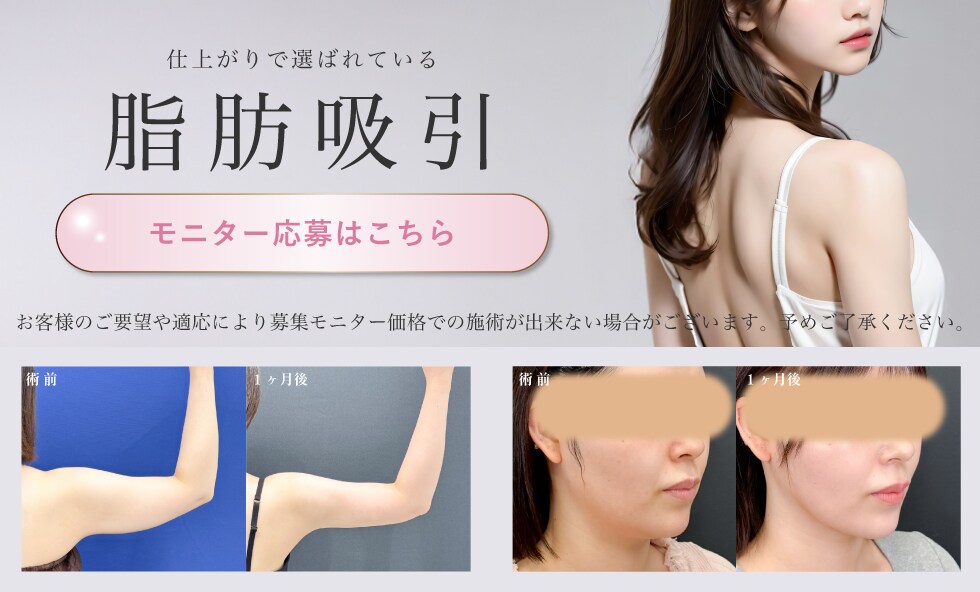 脂肪吸引モニター