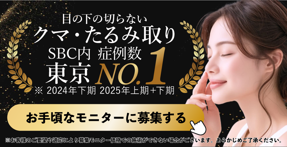 クマ取りモニター募集